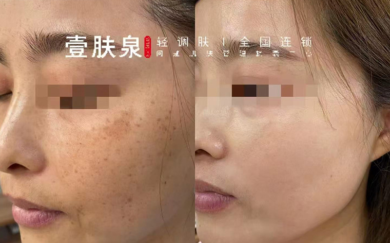 皮肤管理, 美容美体,美甲与美睫,苏州皮肤管理,苏州美容美体,苏州美甲与美睫